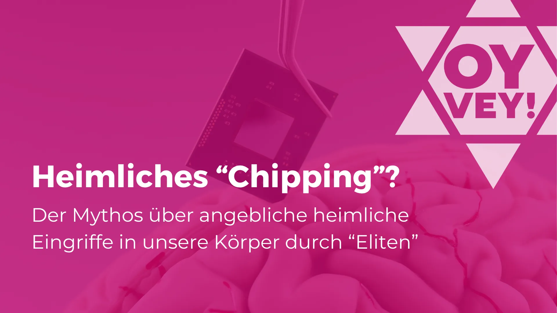 Titelbild des Beitrags zu "Heimliches 'Chipping'?" mit einem Bild, auf dem ein Mikrochip in ein menschliches Gehirn gesteckt wird.